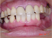 術前チェック 術前チェック