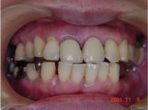 口腔内のチェック 口腔内のチェック